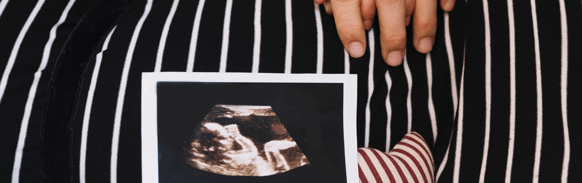 Foto de mulher gravida deitada com ultrassom na barriga segurando mão do marido