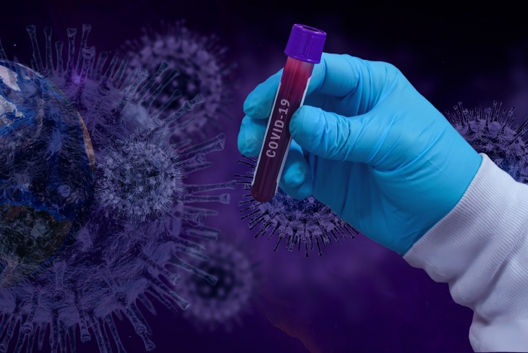 Em primeiro plano, mão com luva de médica segurando um frasco de exame de laboratório com sangue dentro. Ao fundo, ilustrações do coronavírus. 