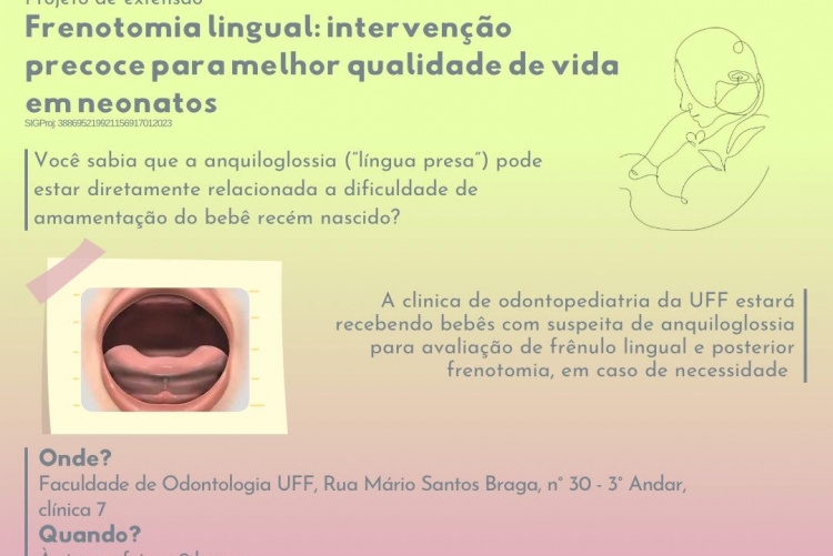Frenotomia lingual: intervenção precoce para melhor qualidade de vida em neonatos