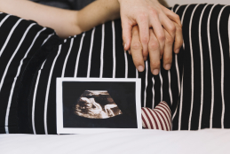 #PraTodosVerem: Na foto uma mulher grávida está usando um vestido listrado preto e branco, com sua mão e uma outra mão, repousadas na barriga e uma foto de um ultrassom gestacional apoiado na barriga.