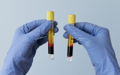 UFF Responde: hábitos e o desafio do controle do colesterol no Brasil