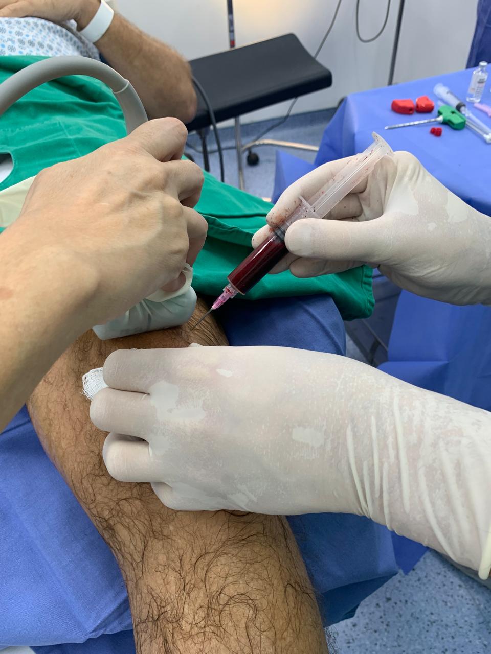 imagem de um procedimento no joelho em centro cirurgico